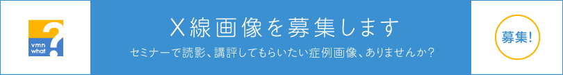 X線画像を募集します セミナーで読影、講評してもらいたい症例画像、ありませんか？